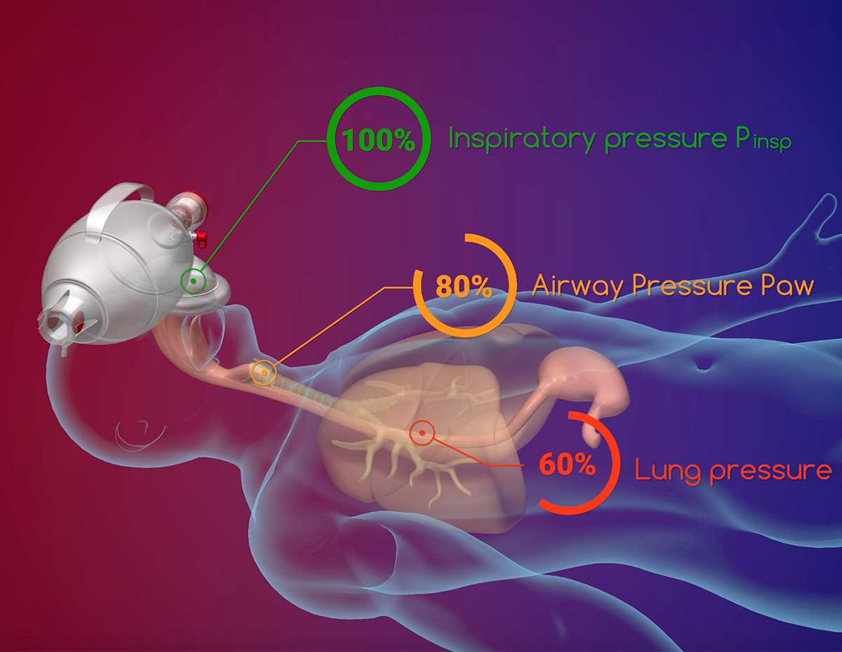 https://manualventilationacademy.org/wp-content/uploads/2024/10/Miniature-Insp.-Pressure-1200x930-1.png